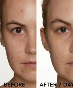 Lancer Skin Care CLARIFYING SPOT SOLUTION WITH 10% SULFUR 7 Lancer Skin Care CLARIFYING SPOT SOLUTION WITH 10% SULFUR