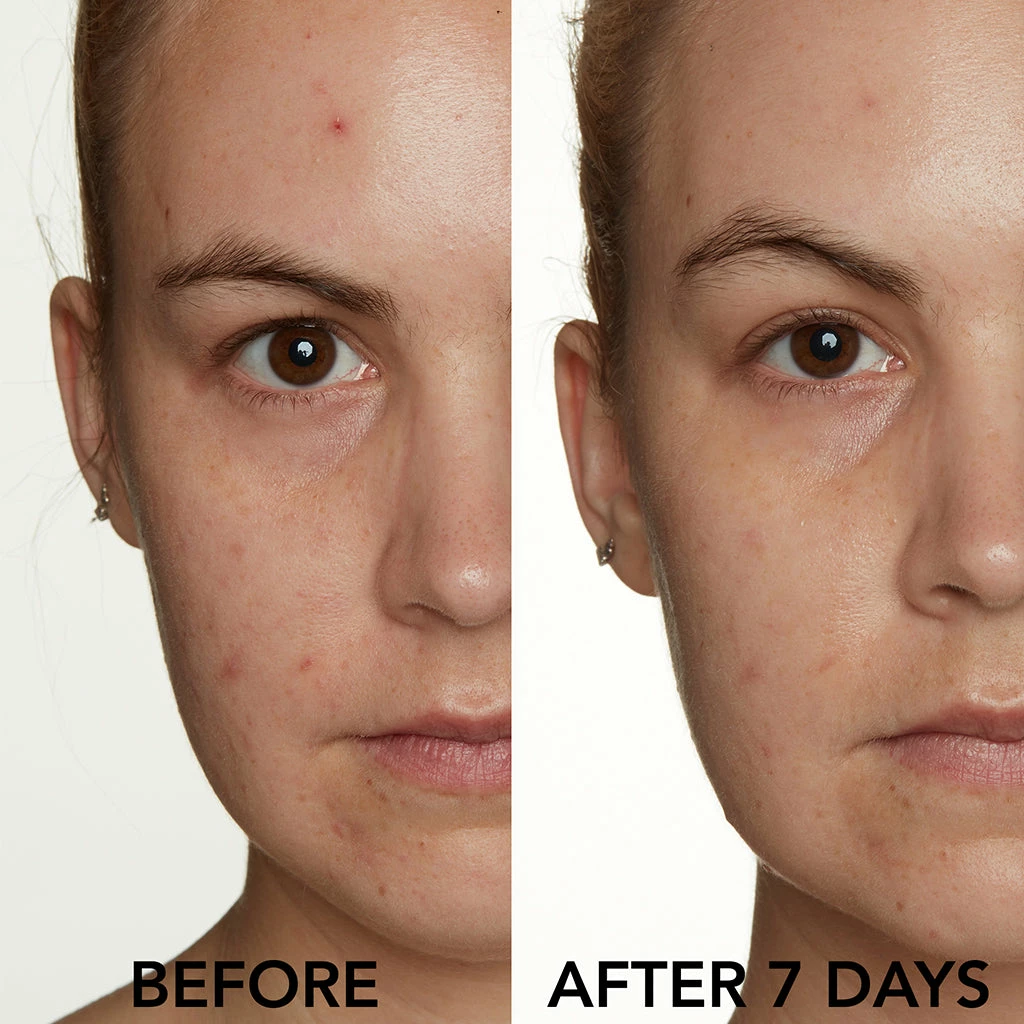 Lancer Skin Care CLARIFYING SPOT SOLUTION WITH 10% SULFUR 3 Lancer Skin Care CLARIFYING SPOT SOLUTION WITH 10% SULFUR