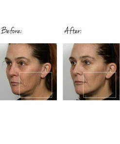 NuFACE TRINITY FACIAL TONING DEVICE