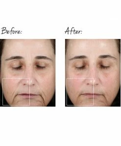 NuFACE TRINITY FACIAL TONING DEVICE