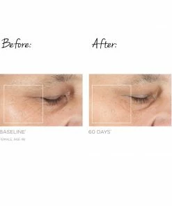 NuFACE TRINITY FACIAL TONING DEVICE