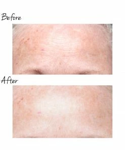 NuFACE Skin Care TRINITY WRINKLE REDUCER ATTACHMENT 6 NuFACE Skin Care TRINITY WRINKLE REDUCER ATTACHMENT