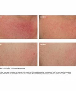 SkinCeuticals GLYCOLIC 10 RENEW OVERNIGHT 6 SkinCeuticals GLYCOLIC 10 RENEW OVERNIGHT