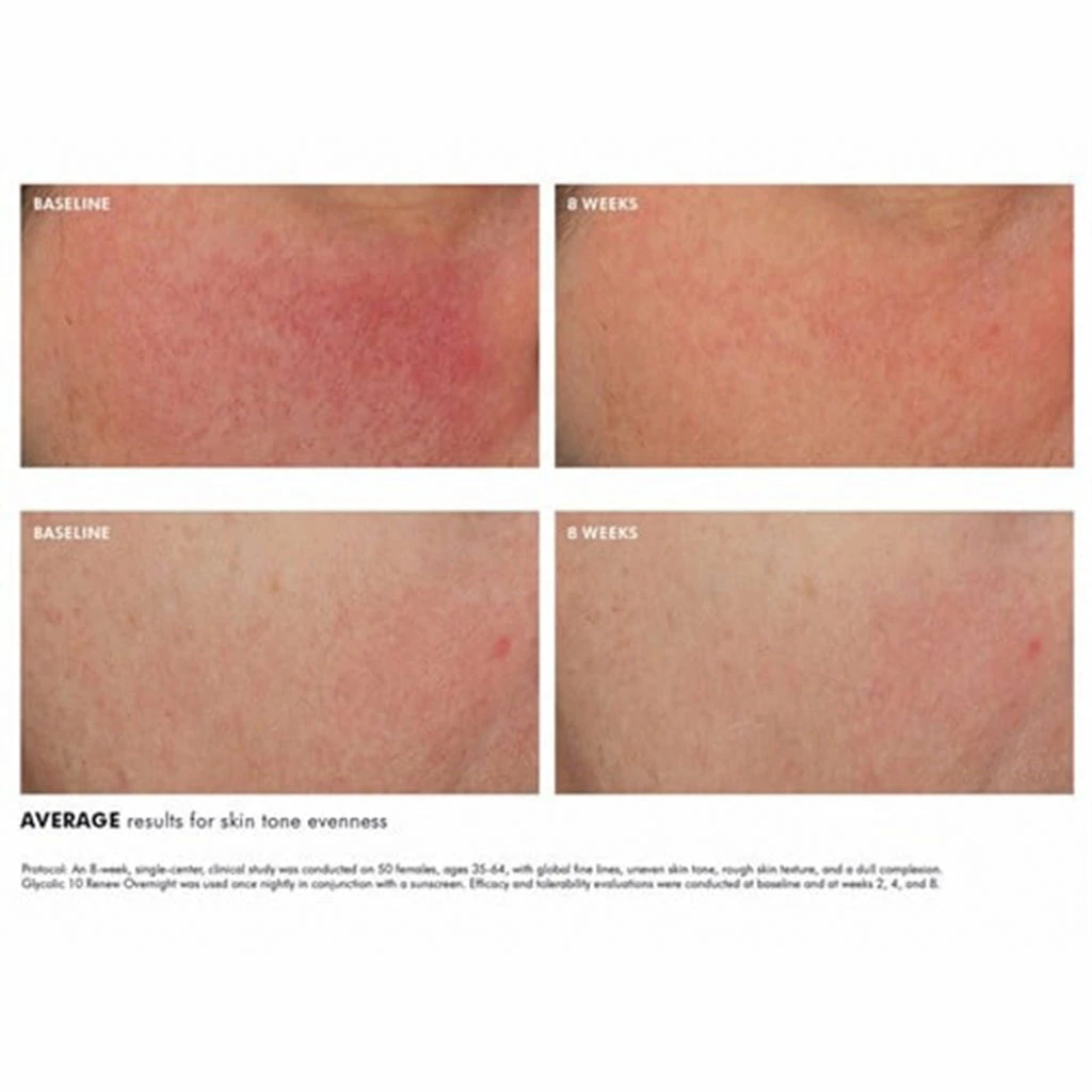 SkinCeuticals GLYCOLIC 10 RENEW OVERNIGHT 3 SkinCeuticals GLYCOLIC 10 RENEW OVERNIGHT